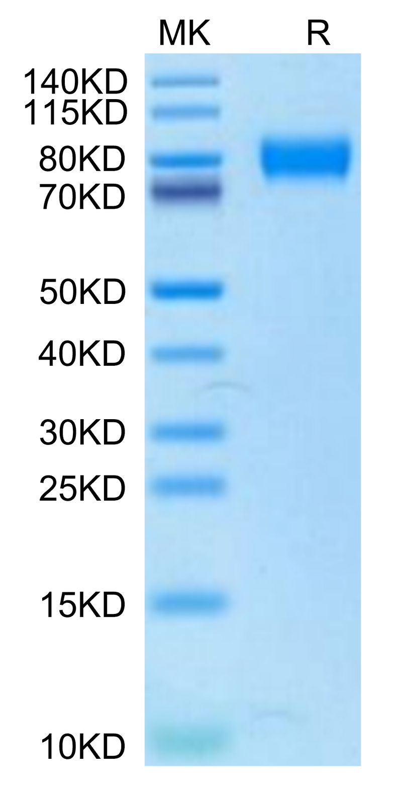 Human IL-2 R gamma on Tris-Bis PAGE under reduced condition. The purity is greater than 95%.Recombinant Human IL-2 R gamma/CD132 Protein