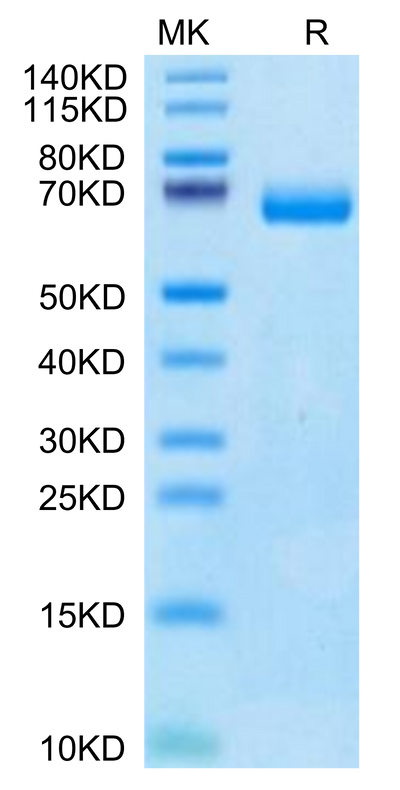 Human IL-2 R beta on Tris-Bis PAGE under reduced condition. The purity is greater than 95%.Recombinant Human IL-2 R beta/CD122 Protein, Active