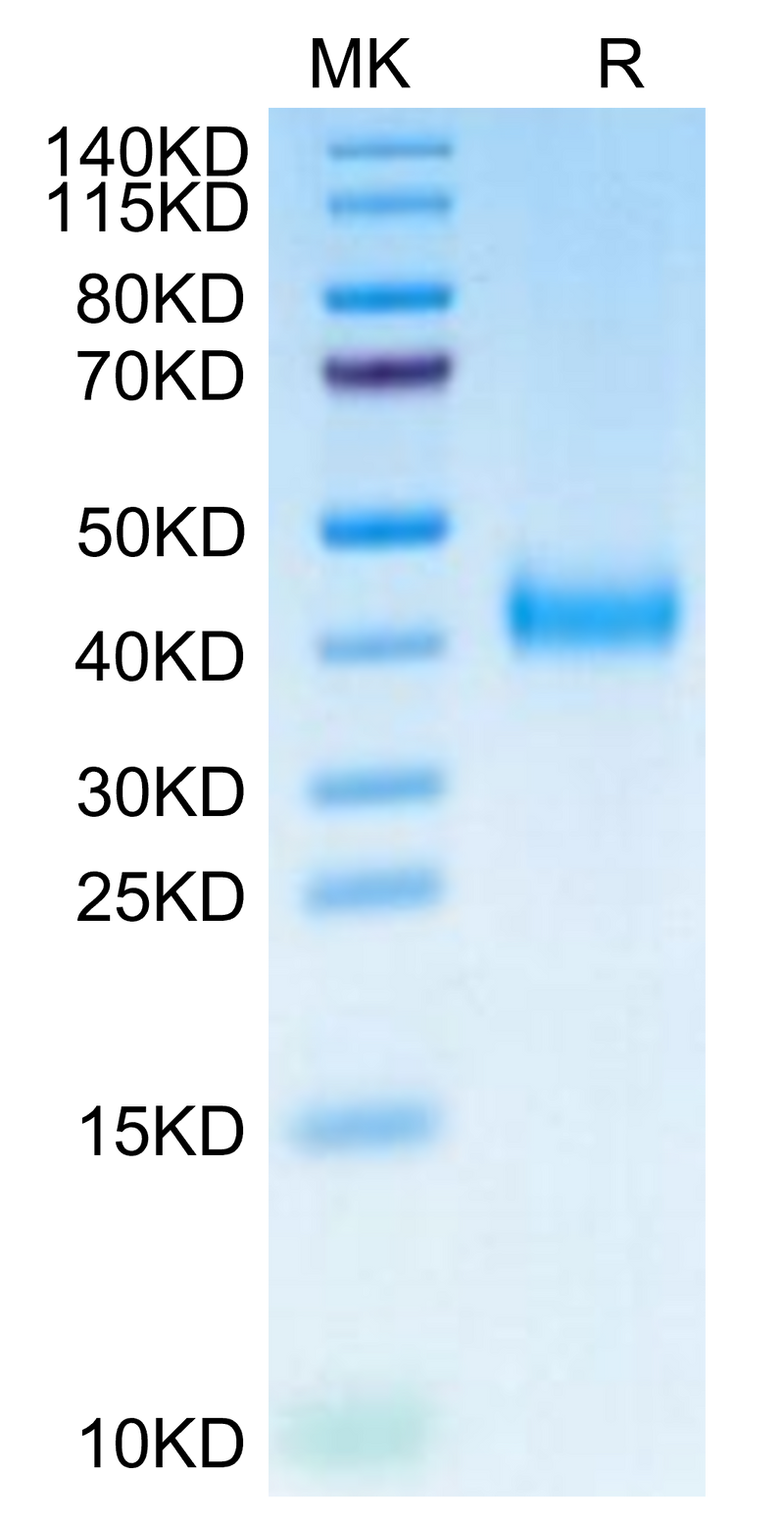 Biotinylated Cynomolgus IL-2 R beta on Tris-Bis PAGE under reduced condition. The purity is greater than 95%.Biotinylated Cynomolgus IL-2 R beta/CD122 Protein (Primary Amine Labeling), Active