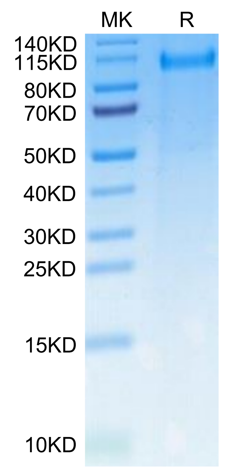 Rat CDCP1 on Tris-Bis PAGE under reduced condition. The purity is greater than 95%.Recombinant Rat CDCP1 Protein