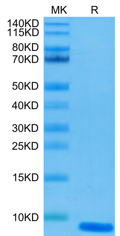 Human EGF on Tris-Bis PAGE under reduced condition. The purity is greater than 95%.Recombinant Human EGF Protein, Active