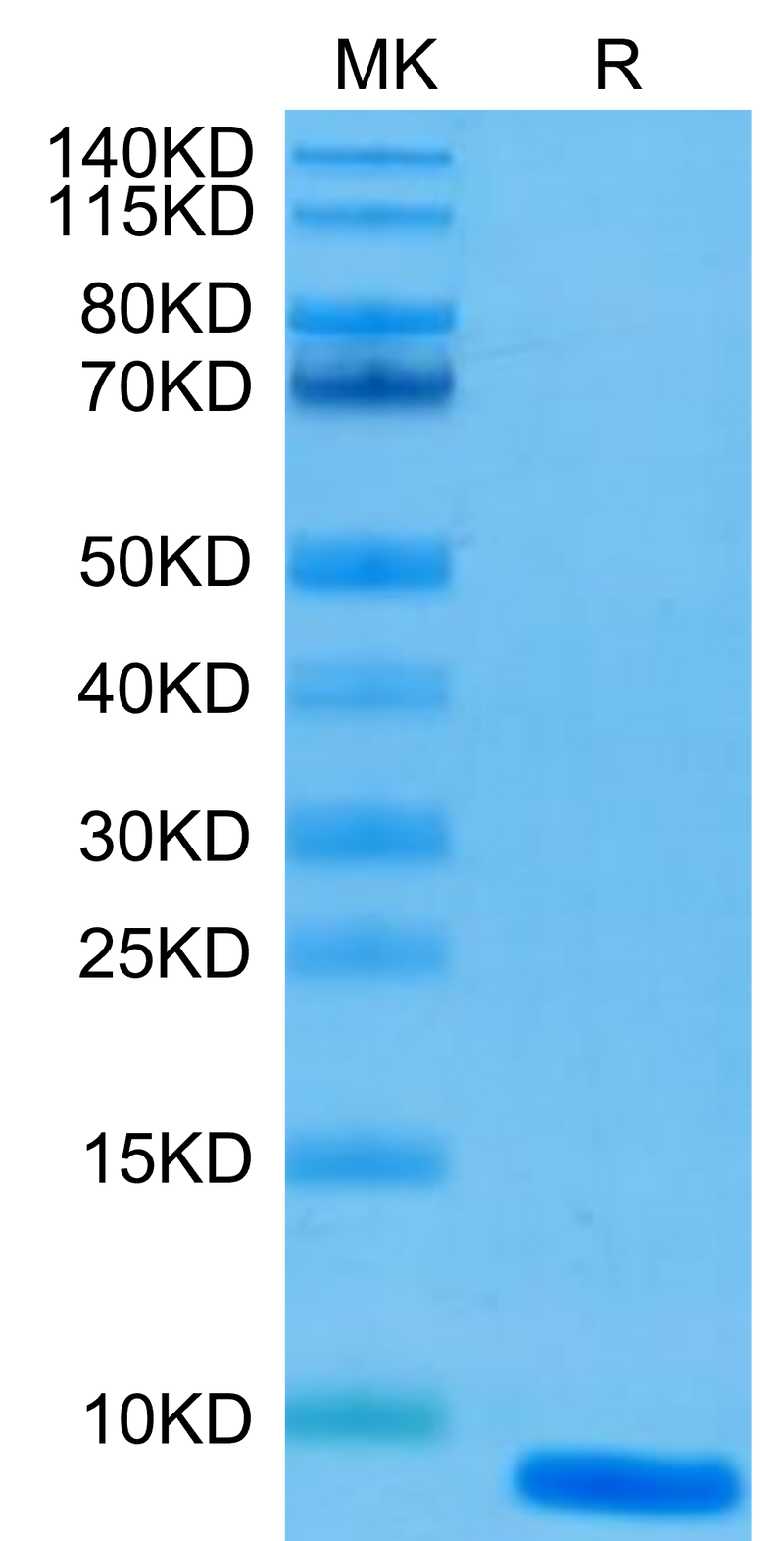 Human EGF on Tris-Bis PAGE under reduced condition. The purity is greater than 95%.Recombinant Human EGF Protein, Active