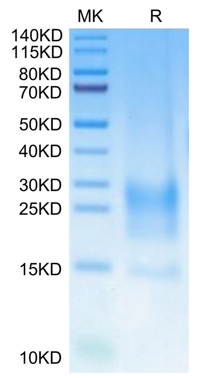 Cynomolgus BST2 on Tris-Bis PAGE under reduced condition. The purity is greater than 95%.Recombinant Cynomolgus BST2 Protein