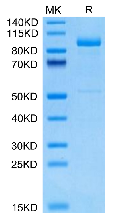 Cynomolgus LRIG1 on Tris-Bis PAGE under reduced condition. The purity is greater than 95%.Recombinant Cynomolgus LRIG1 Protein, Active