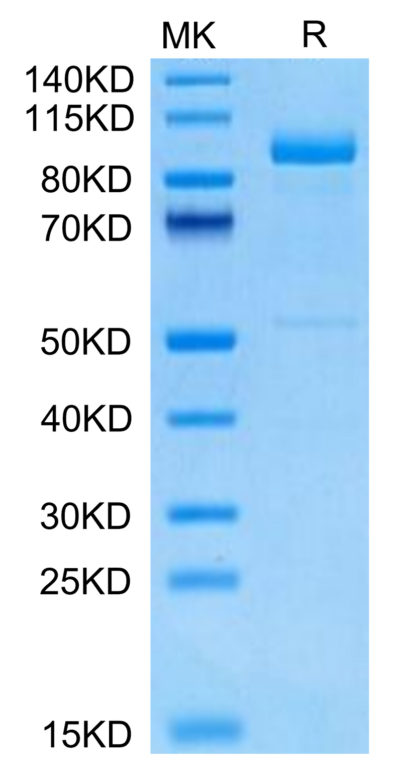 Cynomolgus LRIG1 on Tris-Bis PAGE under reduced condition. The purity is greater than 95%.Recombinant Cynomolgus LRIG1 Protein, Active