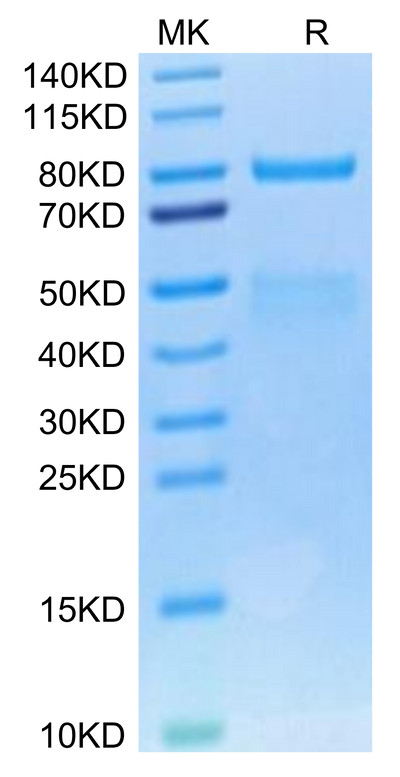 Cynomolgus HGF R on Tris-Bis PAGE under reduced condition. The purity is greater than 95%.Recombinant Cynomolgus HGF R/c-MET Protein, Active