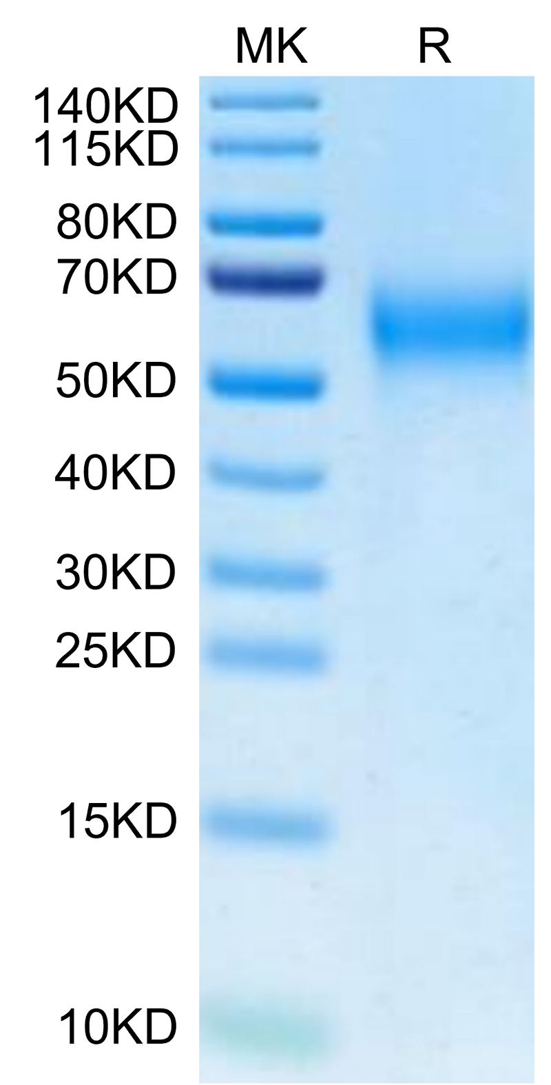 Biotinylated Cynomolgus IL-2 R gamma on Tris-Bis PAGE under reduced condition. The purity is greater than 95%.Biotinylated Cynomolgus IL-2 R gamma/CD132 Protein (Primary Amine Labeling)