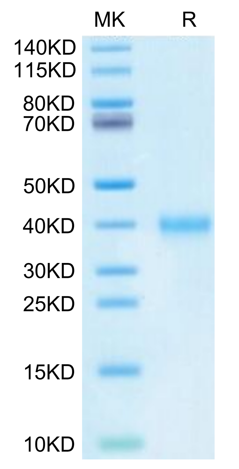 Mouse IGSF11 on Tris-Bis PAGE under reduced condition. The purity is greater than 95%.Recombinant Mouse IGSF11 Protein
