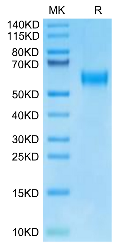 Human IL-18RAP on Tris-Bis PAGE under reduced condition. The purity is greater than 95%.Recombinant Human IL-18RAP Protein, Active