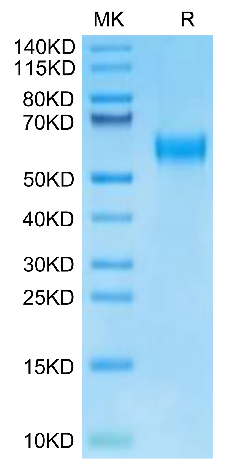 Human IL-18RAP on Tris-Bis PAGE under reduced condition. The purity is greater than 95%.Recombinant Human IL-18RAP Protein, Active