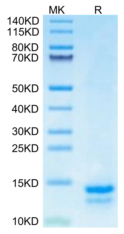 Mouse FAM19A5 on Tris-Bis PAGE under reduced condition. The purity is greater than 95%.Recombinant Mouse FAM19A5 Protein