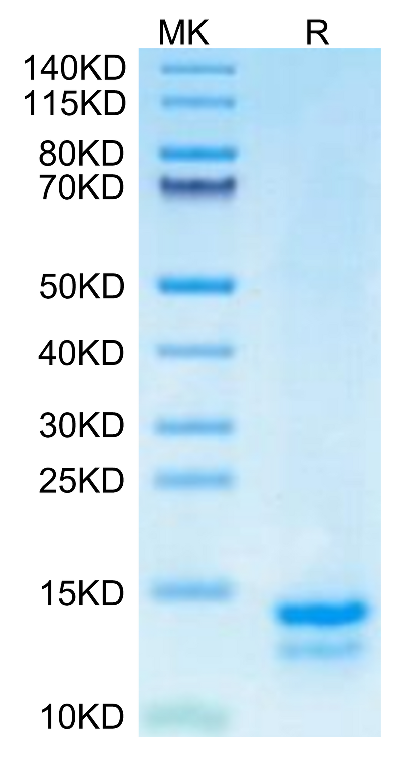 Mouse FAM19A5 on Tris-Bis PAGE under reduced condition. The purity is greater than 95%.Recombinant Mouse FAM19A5 Protein