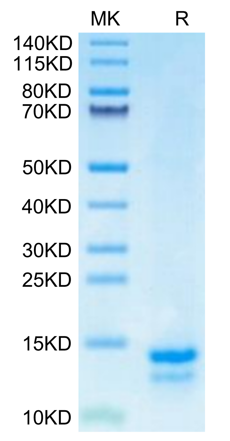 Human FAM19A5 on Tris-Bis PAGE under reduced condition. The purity is greater than 95%.Recombinant Human FAM19A5 Protein