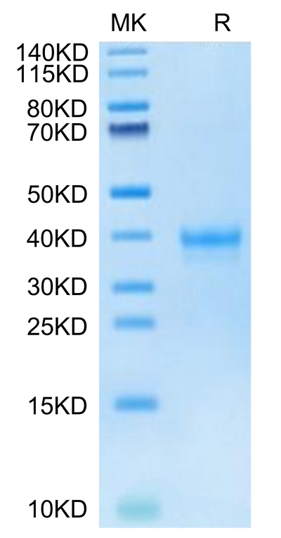 Human IGSF11 on Tris-Bis PAGE under reduced condition. The purity is greater than 95%.Recombinant Human IGSF11 Protein, Active