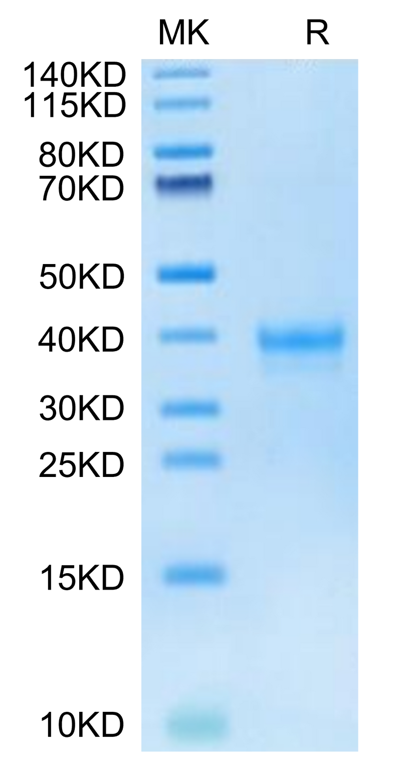 Human IGSF11 on Tris-Bis PAGE under reduced condition. The purity is greater than 95%.Recombinant Human IGSF11 Protein, Active