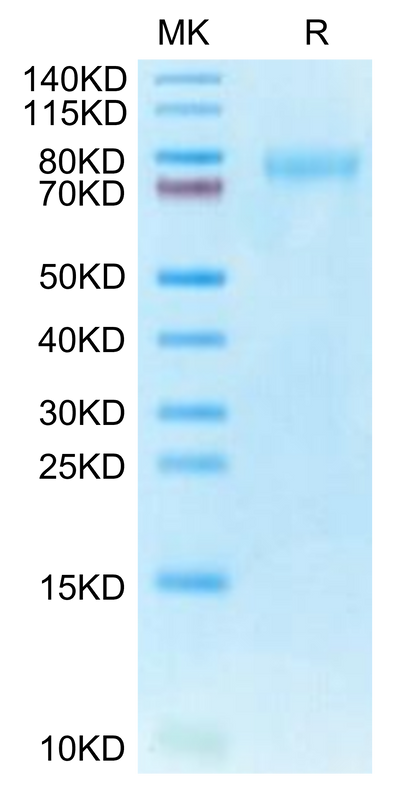 Human CLEC14A on Tris-Bis PAGE under reduced condition. The purity is greater than 95%.Recombinant Human CLEC14A Protein