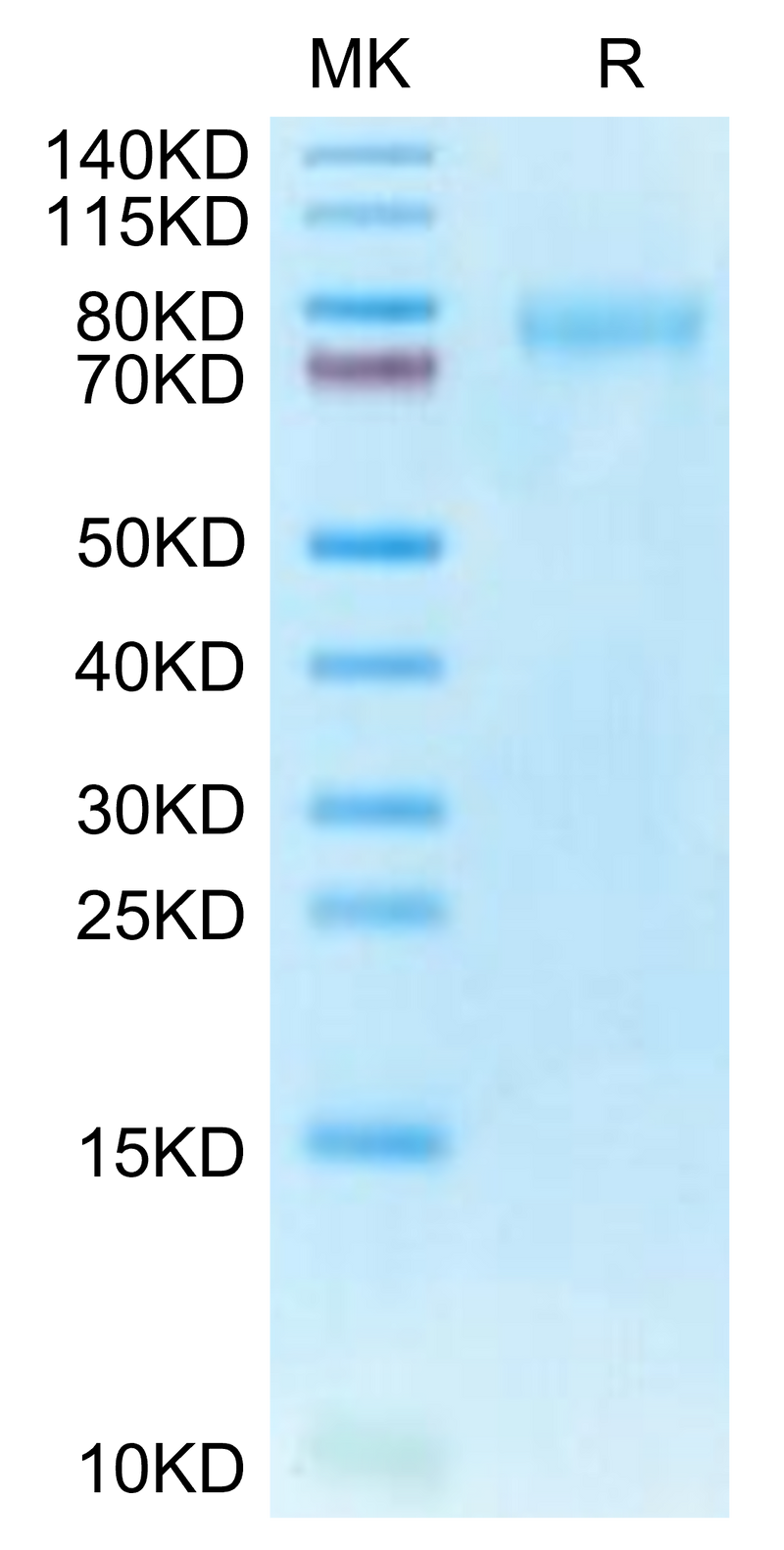Human CLEC14A on Tris-Bis PAGE under reduced condition. The purity is greater than 95%.Recombinant Human CLEC14A Protein