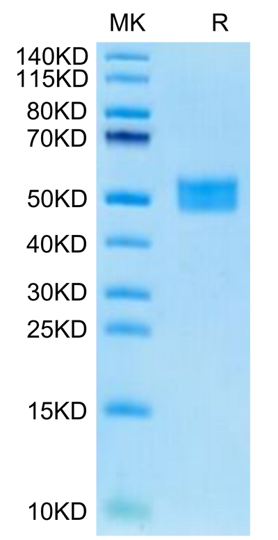 Human FSTL1 on Tris-Bis PAGE under reduced condition. The purity is greater than 95%.Recombinant Human FSTL1 Protein