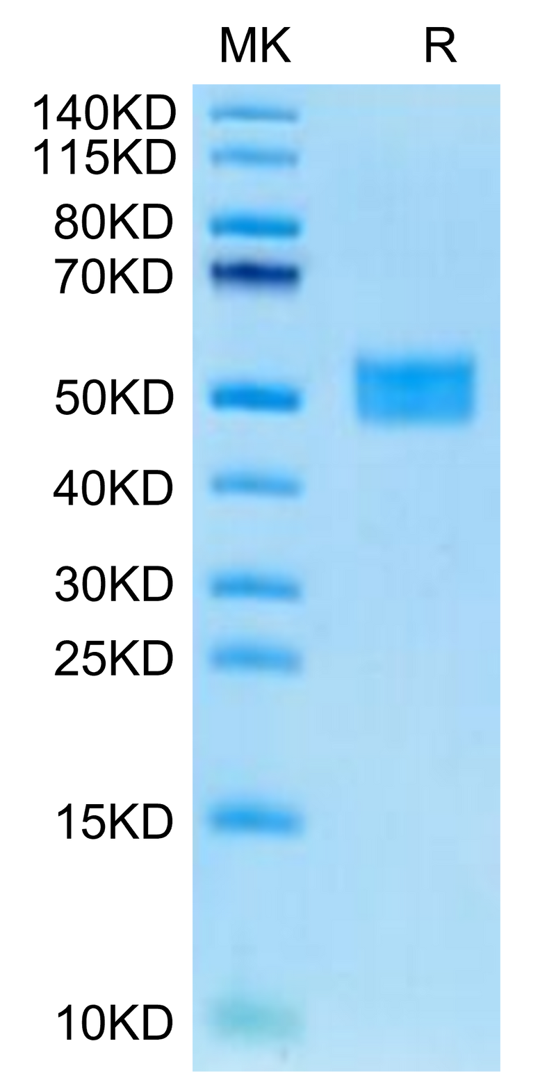 Human FSTL1 on Tris-Bis PAGE under reduced condition. The purity is greater than 95%.Recombinant Human FSTL1 Protein
