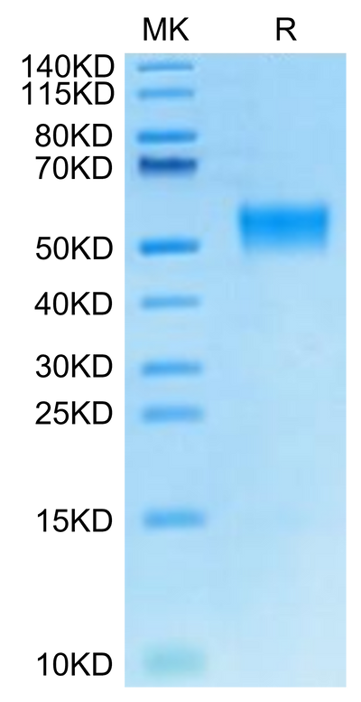 Cynomolgus LRG1 on Tris-Bis PAGE under reduced condition. The purity is greater than 95%.Recombinant Cynomolgus LRG1 Protein, Active
