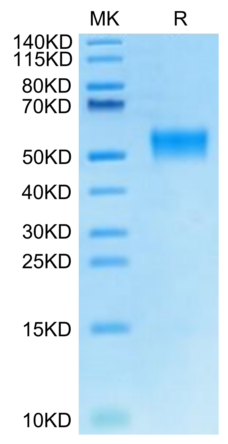 Cynomolgus LRG1 on Tris-Bis PAGE under reduced condition. The purity is greater than 95%.Recombinant Cynomolgus LRG1 Protein, Active