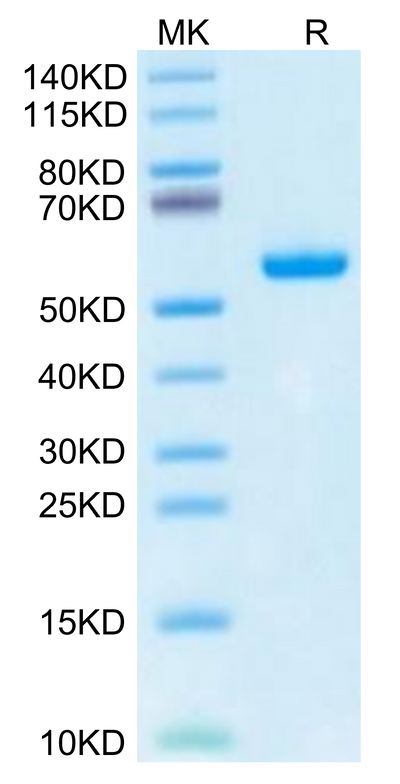 Human HLA-A*02:03&B2M&AFP (FMNKFIYEI) Monomer on Tris-Bis PAGE under reduced condition. The purity is greater than 95%.Recombinant Human HLA-A*02:03&B2M&AFP (FMNKFIYEI) Monomer Protein
