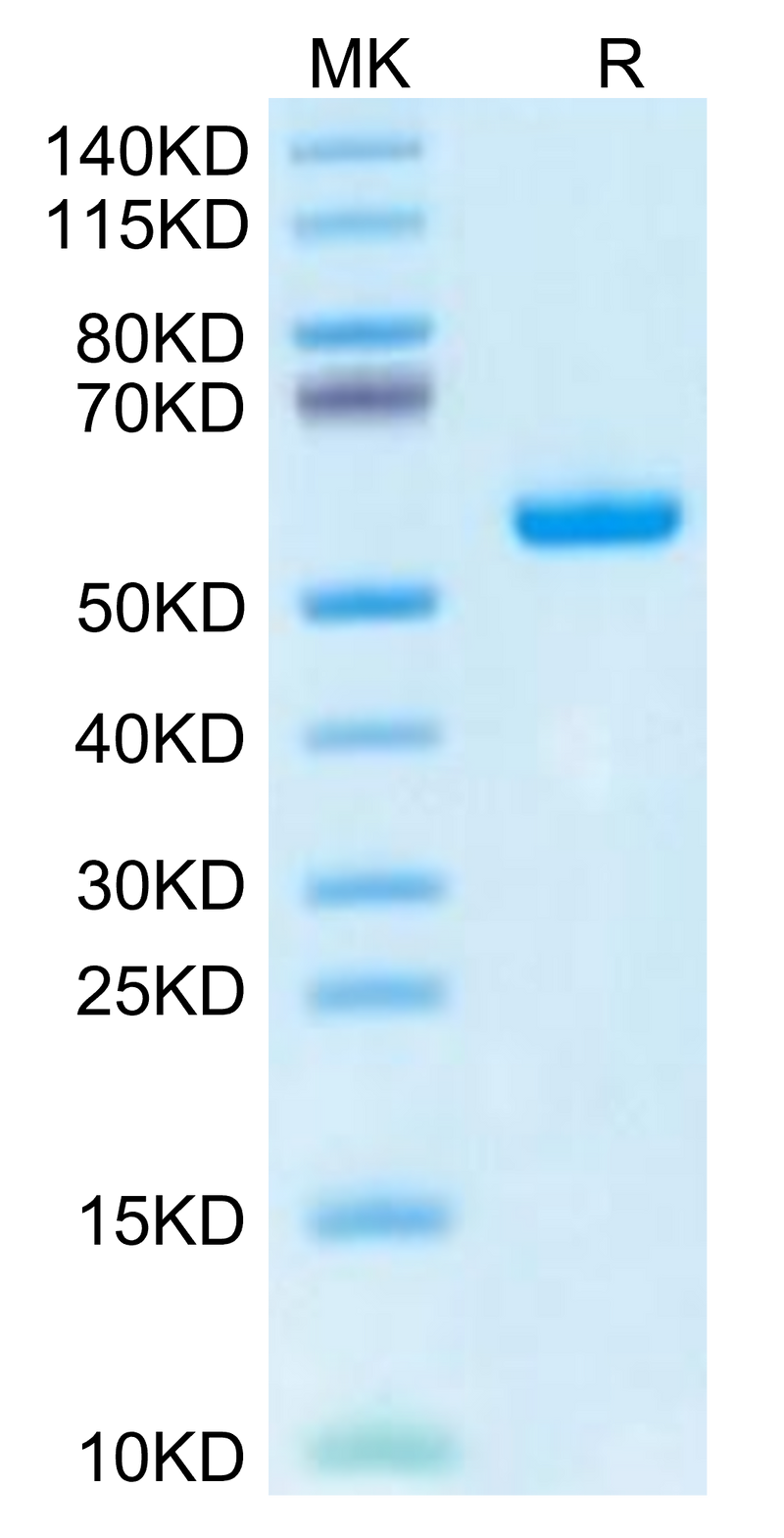 Human HLA-A*02:03&B2M&AFP (FMNKFIYEI) Monomer on Tris-Bis PAGE under reduced condition. The purity is greater than 95%.Recombinant Human HLA-A*02:03&B2M&AFP (FMNKFIYEI) Monomer Protein