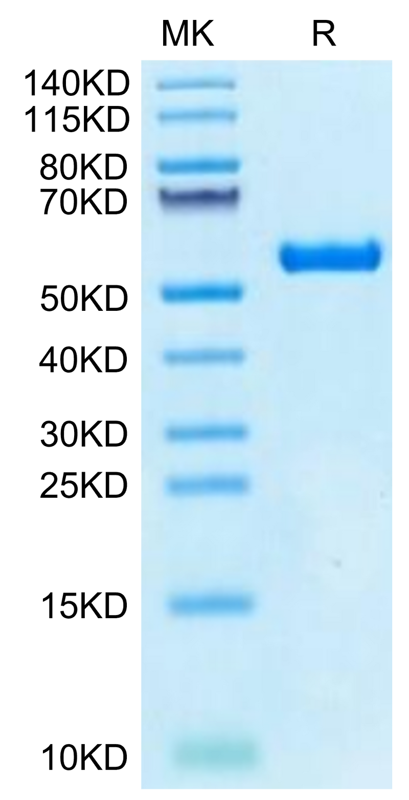 Biotinylated Human HLA-A*02:03&B2M&AFP (FMNKFIYEI) Monomer on Tris-Bis PAGE under reduced condition. The purity is greater than 95%.Biotinylated Human HLA-A*02:03&B2M&AFP (FMNKFIYEI) Monomer Protein