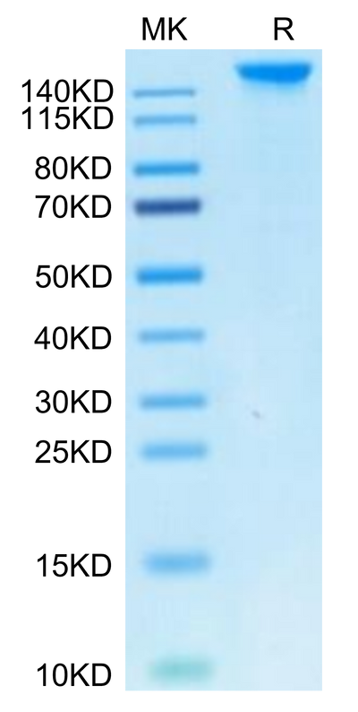 Cynomolgus SEZ6 on Tris-Bis PAGE under reduced condition. The purity is greater than 95%.Recombinant Cynomolgus SEZ6 Protein, Active