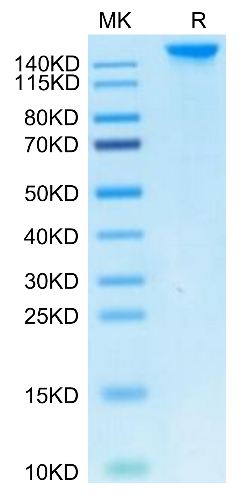 Cynomolgus SEZ6 on Tris-Bis PAGE under reduced condition. The purity is greater than 95%.Recombinant Cynomolgus SEZ6 Protein, Active