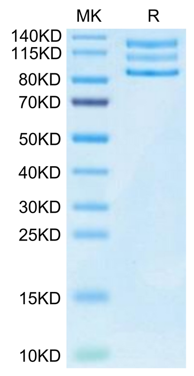 Mouse ITGAV&ITGB3 on Tris-Bis PAGE under reduced condition. The purity is greater than 95%.Recombinant Mouse Integrin alpha V beta 3 (ITGAV&ITGB3) Heterodimer Protein