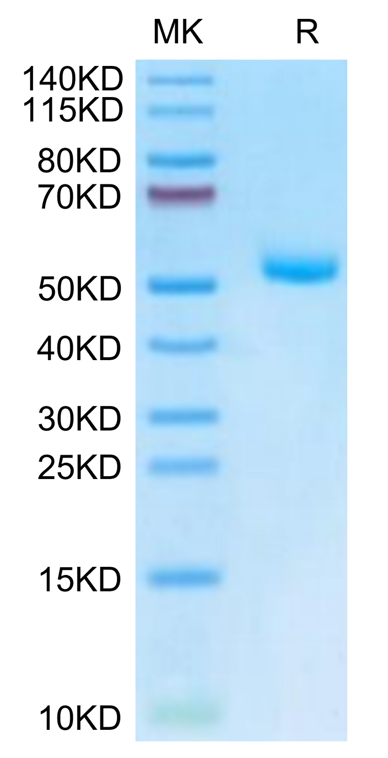 Mouse EVA-1 on Tris-Bis PAGE under reduced condition. The purity is greater than 95%.Recombinant Mouse EVA-1/MPZL2 Protein
