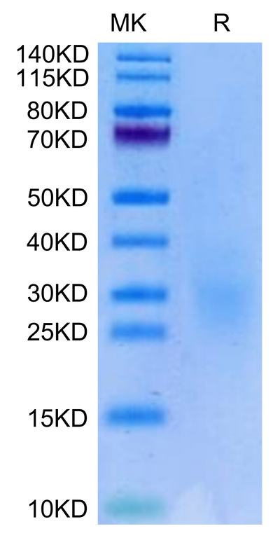 Biotinylated Human NKG2C&CD94 on Tris-Bis PAGE under reduced condition. The purity is greater than 95%.Biotinylated Human NKG2C&CD94 Protein