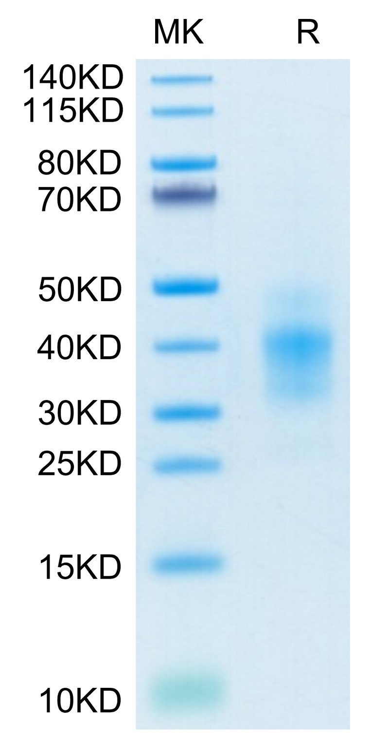 Human NKG2C&CD94 on Tris-Bis PAGE under reduced conditions. The purity is greater than 95%.Recombinant Human NKG2C&CD94 Protein, Active