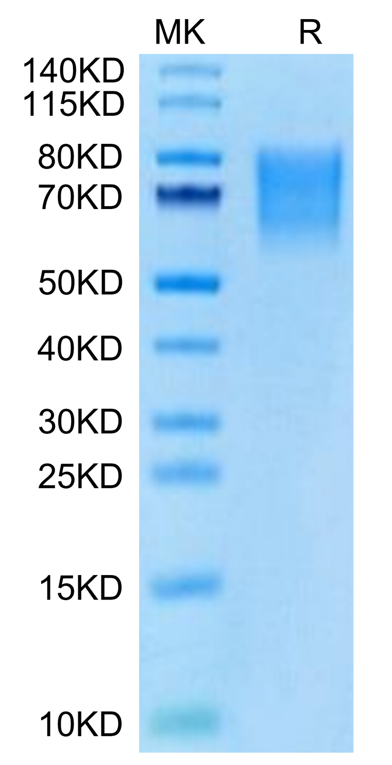 Cynomolgus BSPII on Tris-Bis PAGE under reduced condition. The purity is greater than 95%.Recombinant Cynomolgus BSPII Protein