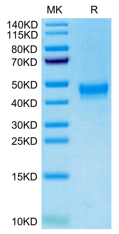 Cynomolgus/Rhesus macaque DKK1 Tris-Bis PAGE under reduced condition. The purity is greater than 95%.Recombinant Cynomolgus/Rhesus macaque DKK1 Protein, Active