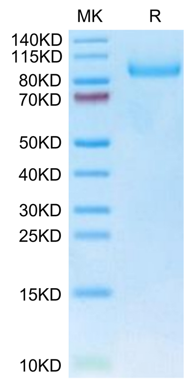 Human Neuropilin-1 on Tris-Bis PAGE under reduced condition. The purity is greater than 95%.Recombinant Human Neuropilin-1 Protein, Active