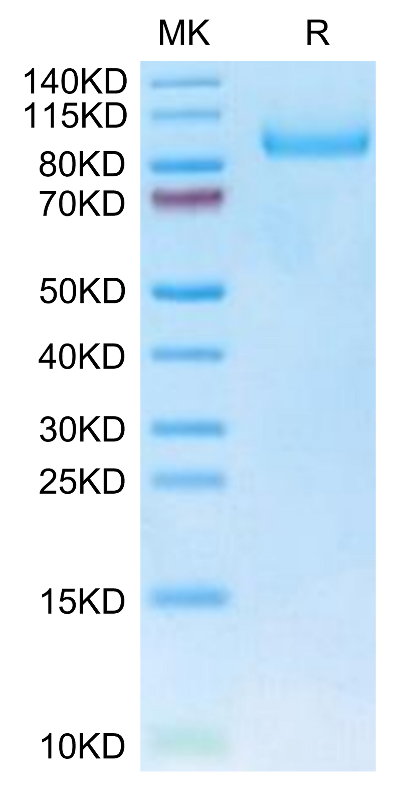 Human Neuropilin-1 on Tris-Bis PAGE under reduced condition. The purity is greater than 95%.Recombinant Human Neuropilin-1 Protein, Active