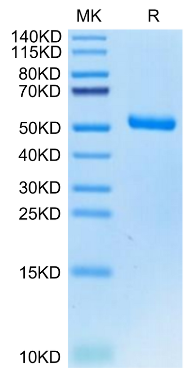 Human EVA-1 on Tris-Bis PAGE under reduced condition. The purity is greater than 95%.Recombinant Human EVA-1/MPZL2 Protein
