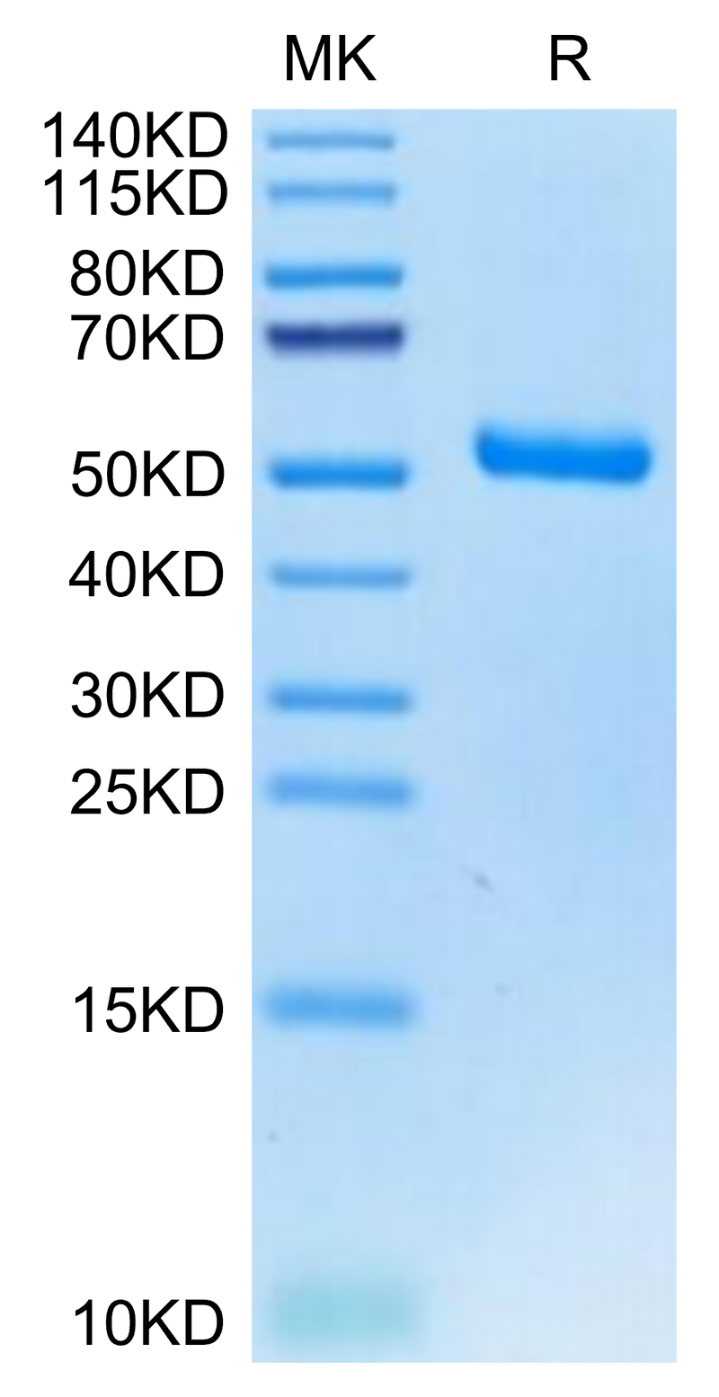 Human EVA-1 on Tris-Bis PAGE under reduced condition. The purity is greater than 95%.Recombinant Human EVA-1/MPZL2 Protein