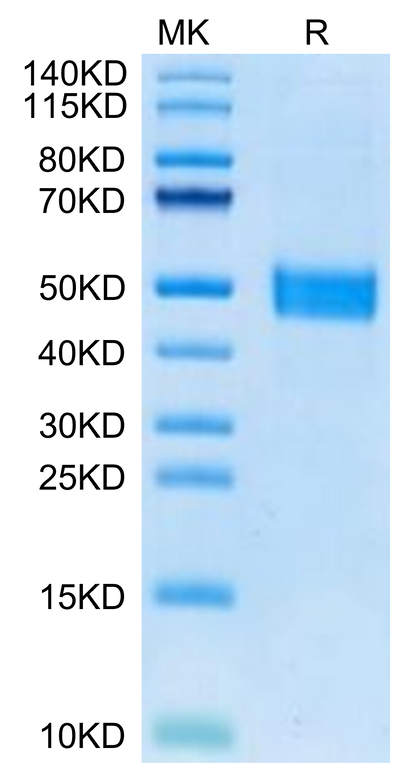Mouse FSTL1 on Tris-Bis PAGE under reduced condition. The purity is greater than 95%.Recombinant Mouse FSTL1 Protein