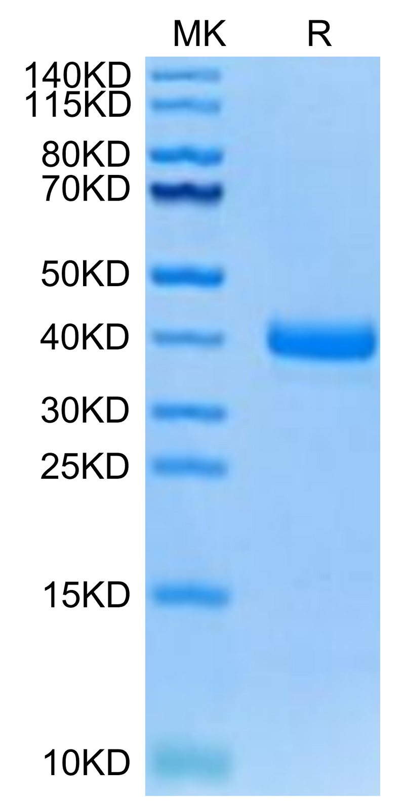 Canine Coagulation Factor III on Tris-Bis PAGE under reduced condition. The purity is greater than 95%.Recombinant Canine Coagulation Factor III/Tissue Factor Protein