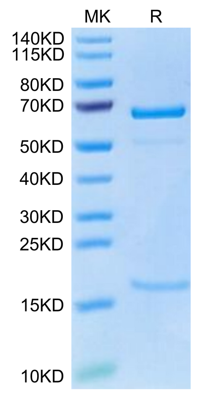 Cynomolgus PCSK9 on Tris-Bis PAGE under reduced condition. The purity is greater than 95%.Recombinant Cynomolgus PCSK9 Protein, Active