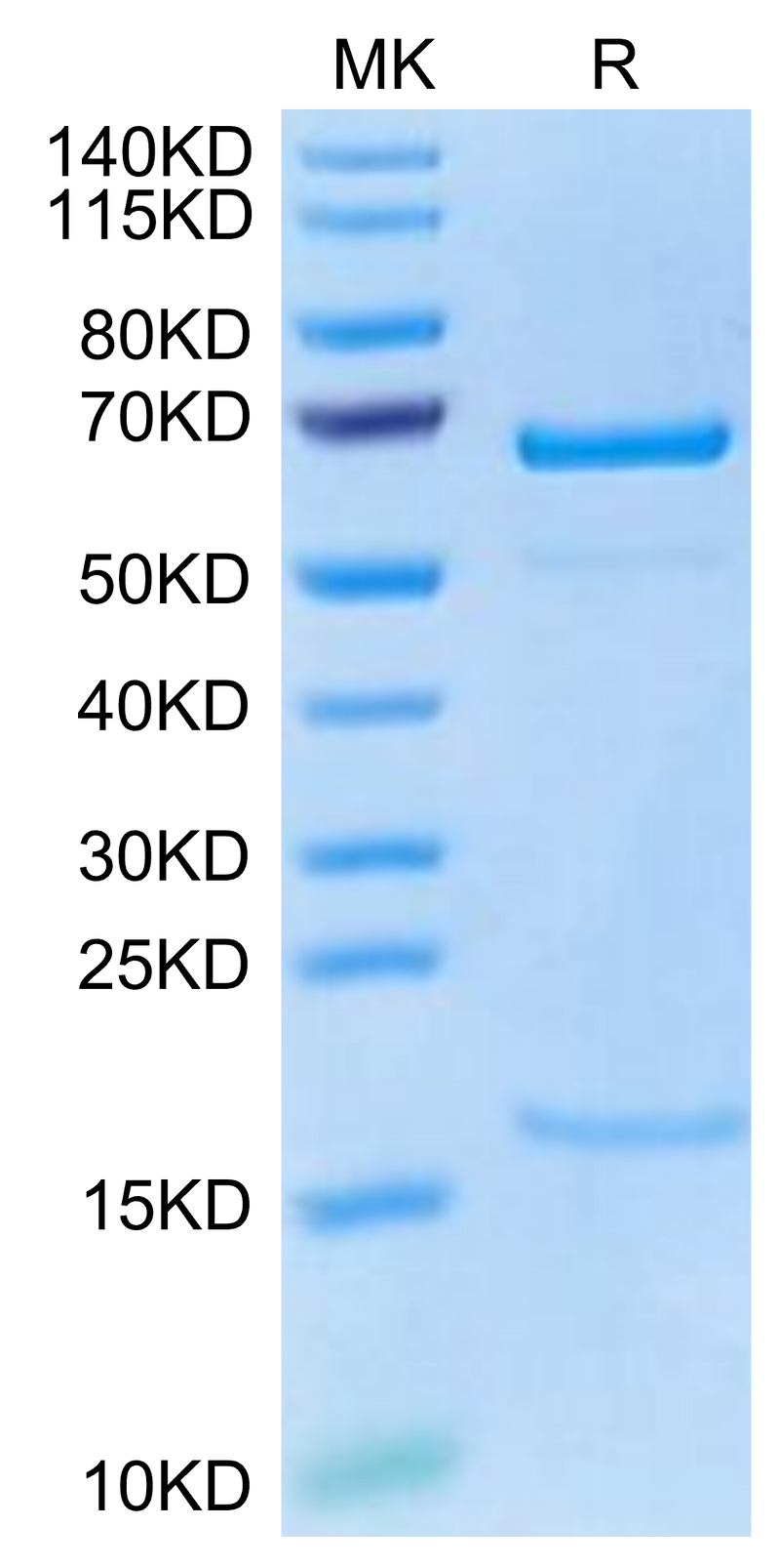 Cynomolgus PCSK9 on Tris-Bis PAGE under reduced condition. The purity is greater than 95%.Recombinant Cynomolgus PCSK9 Protein, Active