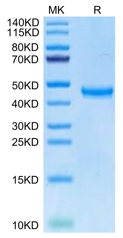 Human TSPAN8 on Tris-Bis PAGE under reduced condition. The purity is greater than 95%.Recombinant Human TSPAN8 Protein