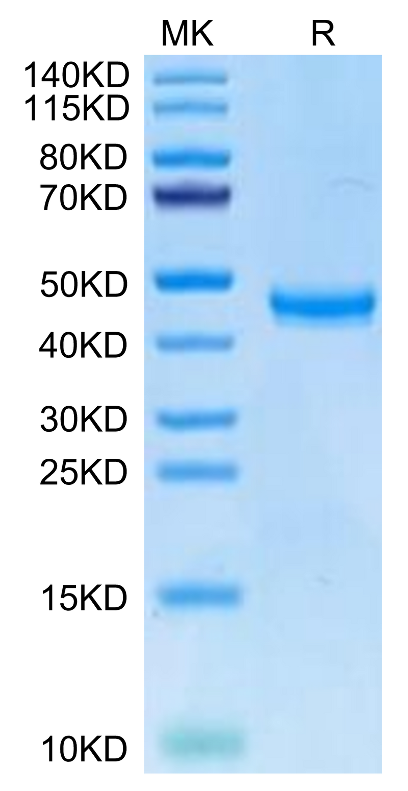 Human TSPAN8 on Tris-Bis PAGE under reduced condition. The purity is greater than 95%.Recombinant Human TSPAN8 Protein