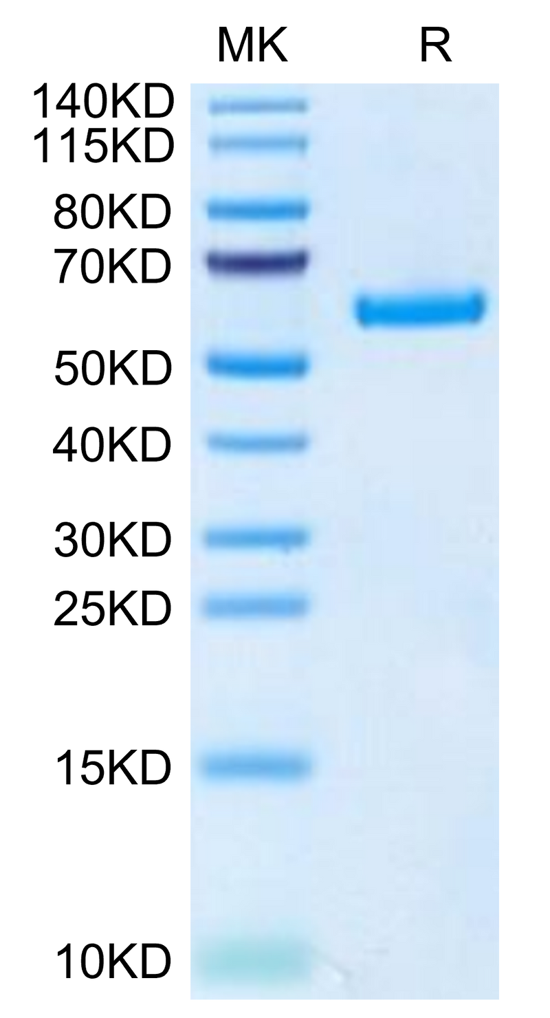 Human TNFRSF11A on Tris-Bis PAGE under reduced condition. The purity is greater than 95%.Recombinant Human TNFRSF11A/Rank Protein, Active