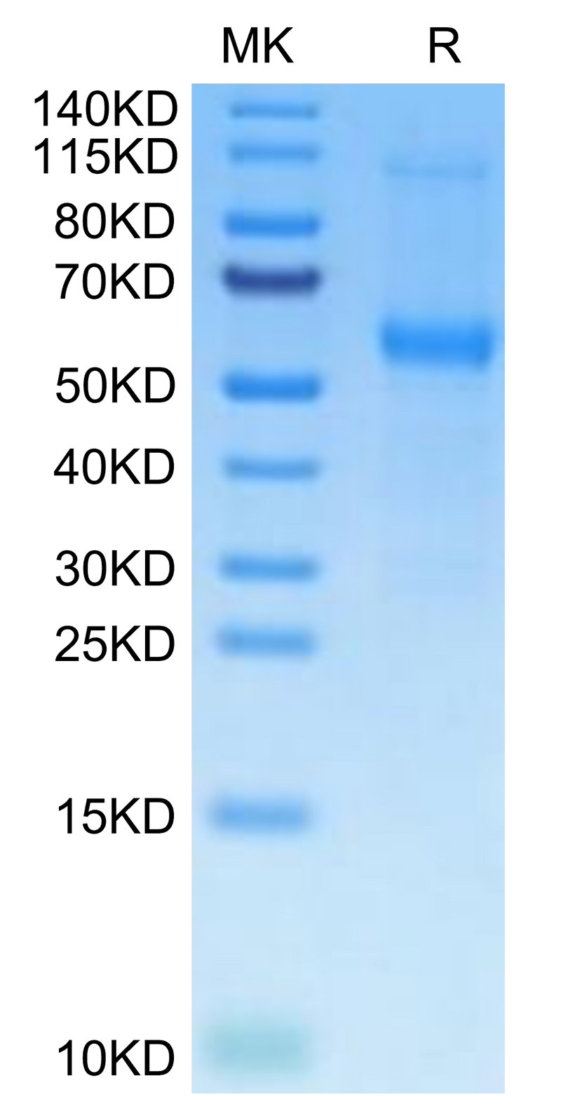 Mouse TNFRSF11B on Tris-Bis PAGE under reduced condition. The purity is greater than 95%.Recombinant Mouse TNFRSF11B Protein