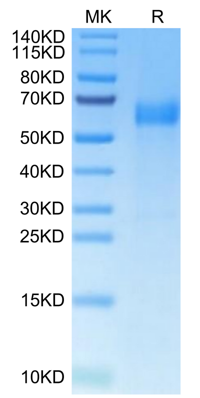 Human B7-H7 on Tris-Bis PAGE under reduced condition. The purity is greater than 95%.Recombinant Human B7-H7/HHLA2 Protein, Active