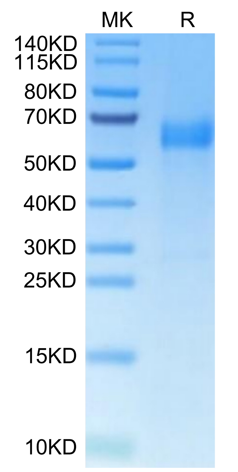Human B7-H7 on Tris-Bis PAGE under reduced condition. The purity is greater than 95%.Recombinant Human B7-H7/HHLA2 Protein, Active
